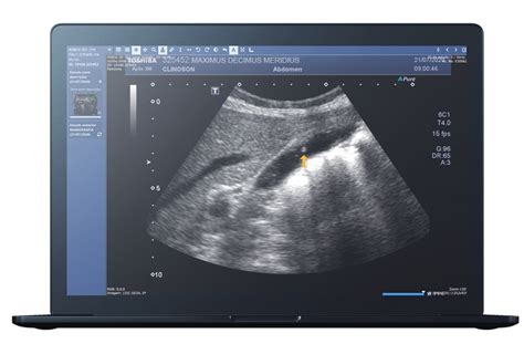 optixone exames|Iba pa.